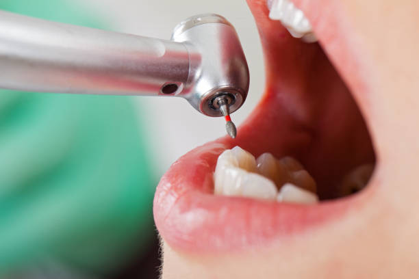 Best Emergency Denture Repair in Oxford, KS